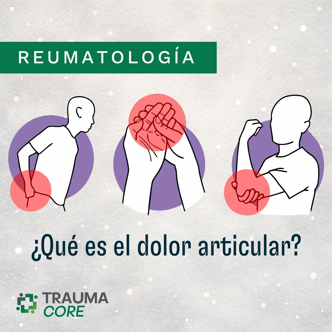 Qué es el dolor articular @ TraumaCore - Núcleo Traumatológico Especializado • Santo Domingo, República Dominicana